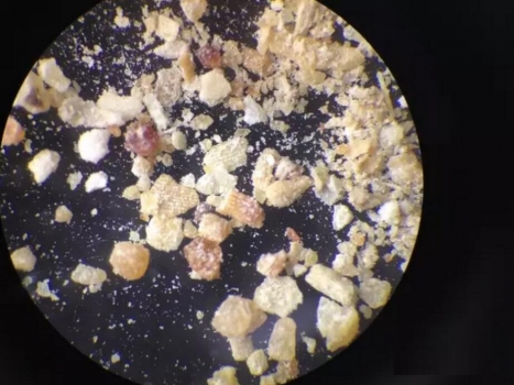 你們廠里的發酵豆粕鏡檢了嗎？