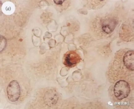 飼料營養抗非瘟的探討