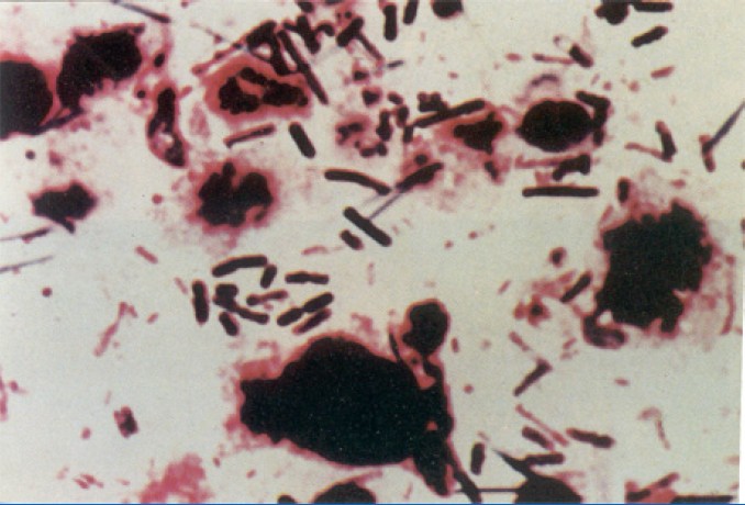 糞便樣品圖片，可見單一的大桿狀細菌