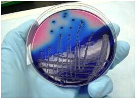 驚爆！耐抗生素細(xì)菌的弱點(diǎn)被發(fā)現(xiàn)了